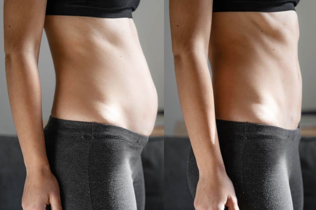 Post-Pregnancy: What Happens to Your Abdominal Muscles After Birth Hampstead Garden Suburb