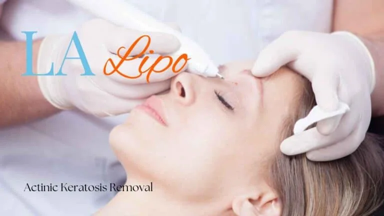 Woman receiving Actinic Keratosis Removal Treatment Hampstead Garden Suburb