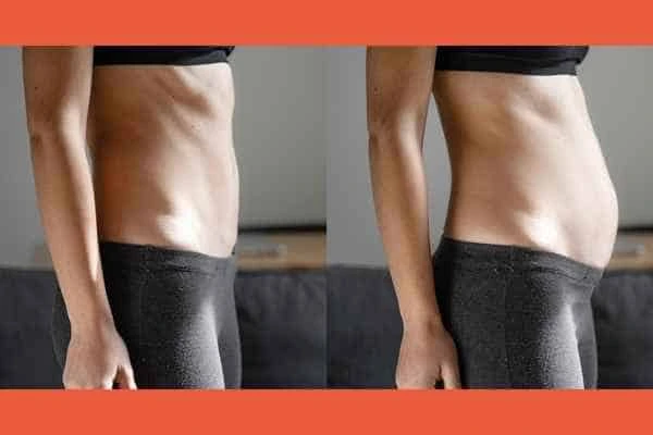 LA-EMS Body Sculpting results Hampstead Garden Suburb