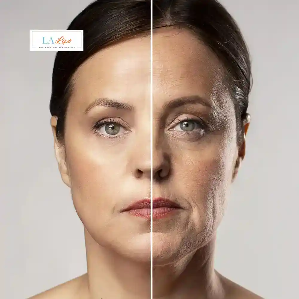 How Can You Tell If Non-Surgical Skin Tightening Is Right for You Hampstead Garden Suburb?
