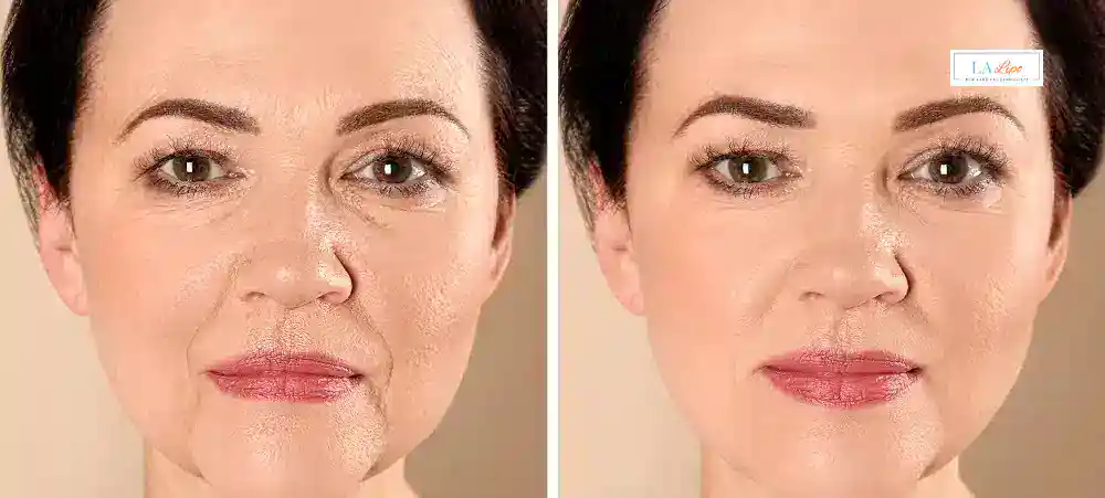 Why Aren’t My Skincare Products Making My Sagging Skin Look Firmer Hampstead Garden Suburb?