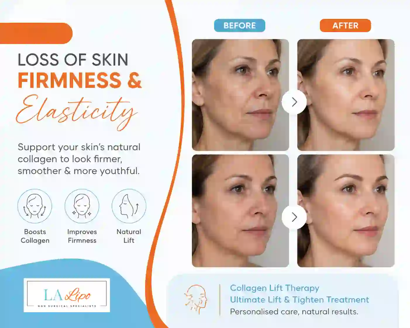 Sign #7: Loss of Skin Firmness and Elasticity Hampstead Garden Suburb