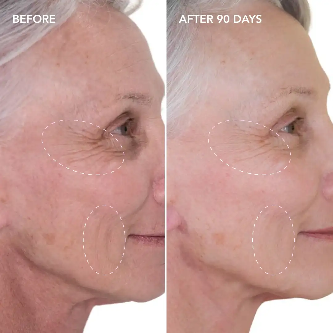 When will you see results Hampstead Garden Suburb